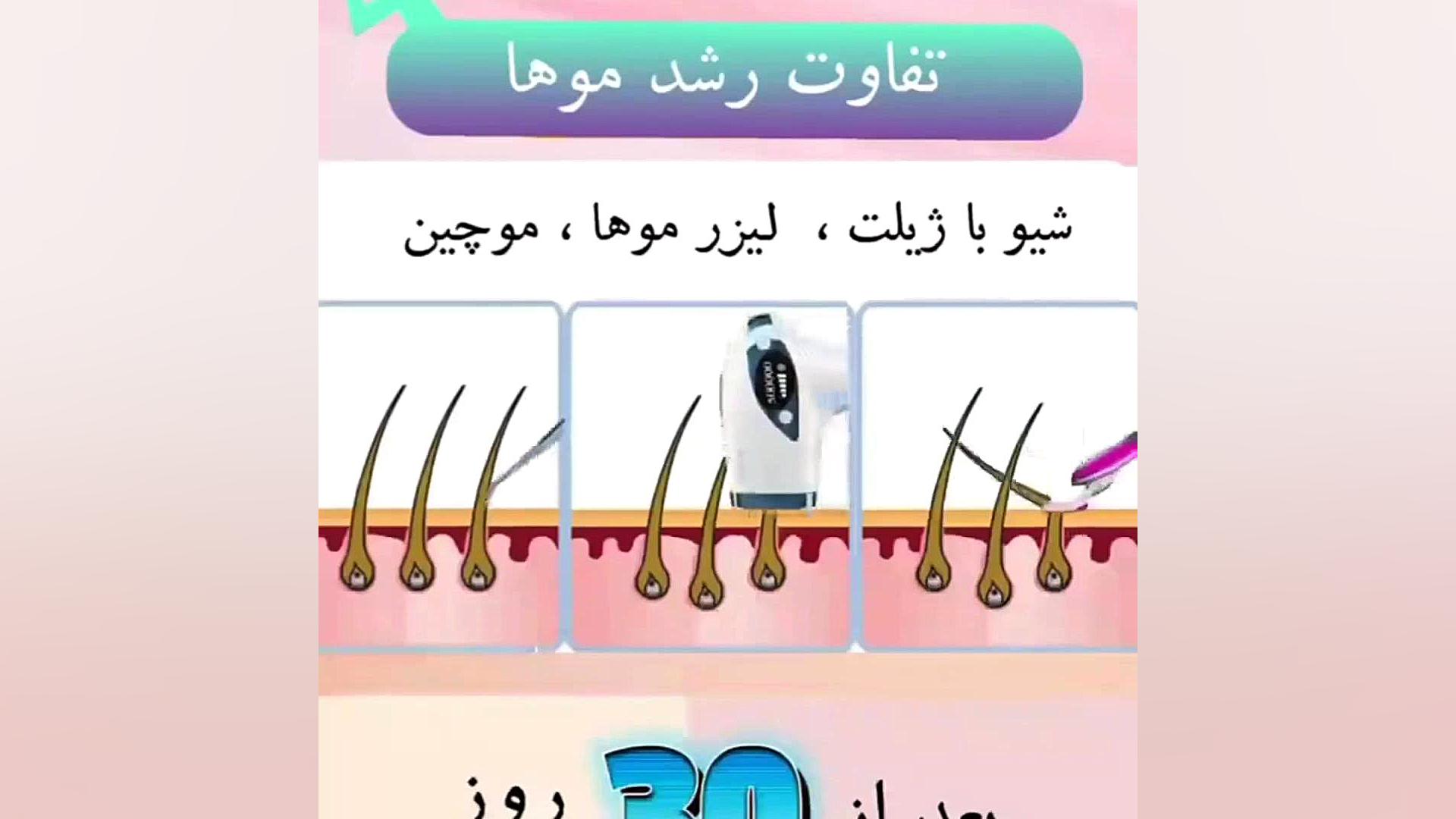 فرق رشد مو با لیزر و ژیلت دکتر امیر سلیمانی