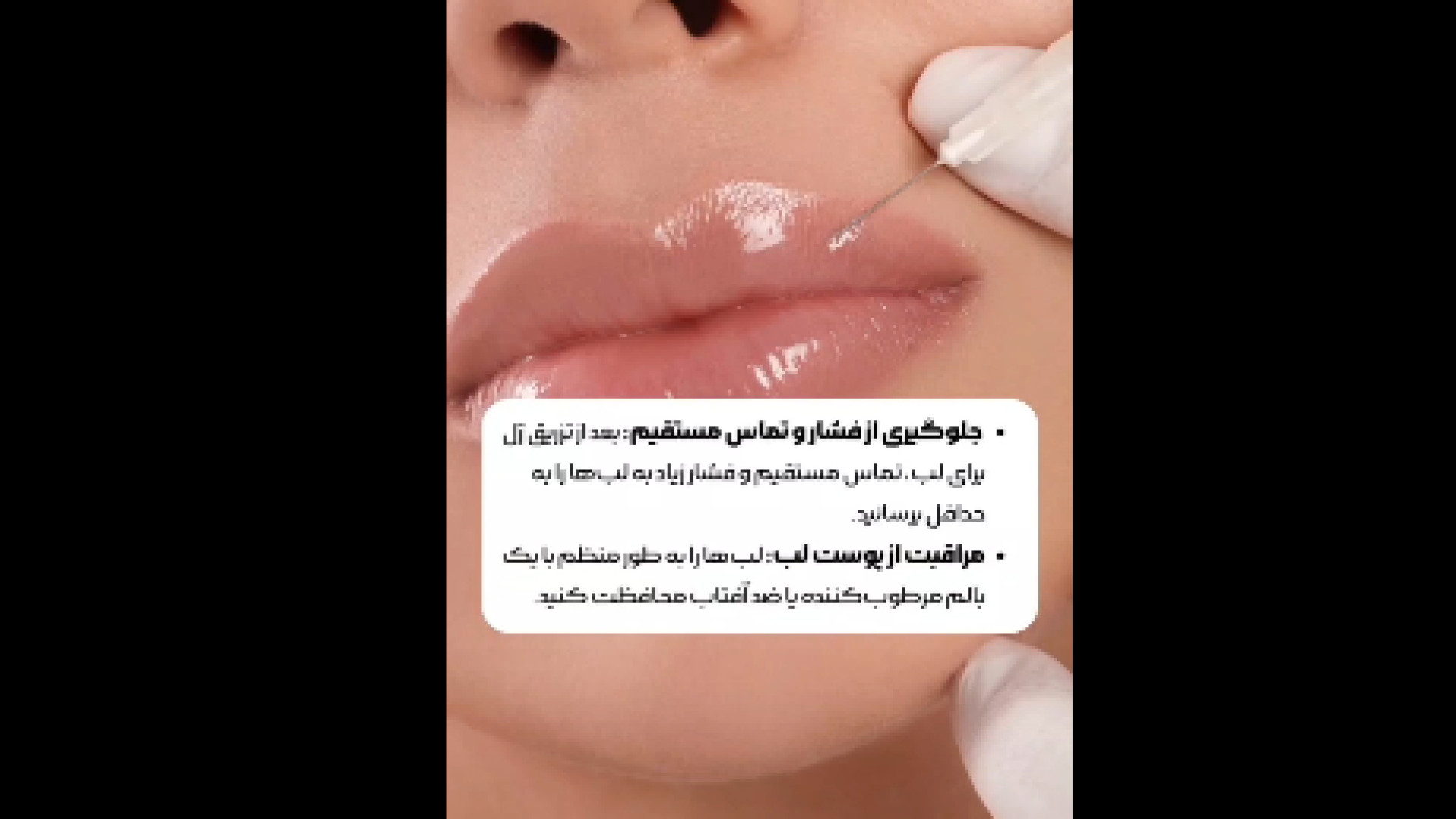 نکات ماندگاری ژل لب دکتر امیر سلیمانی