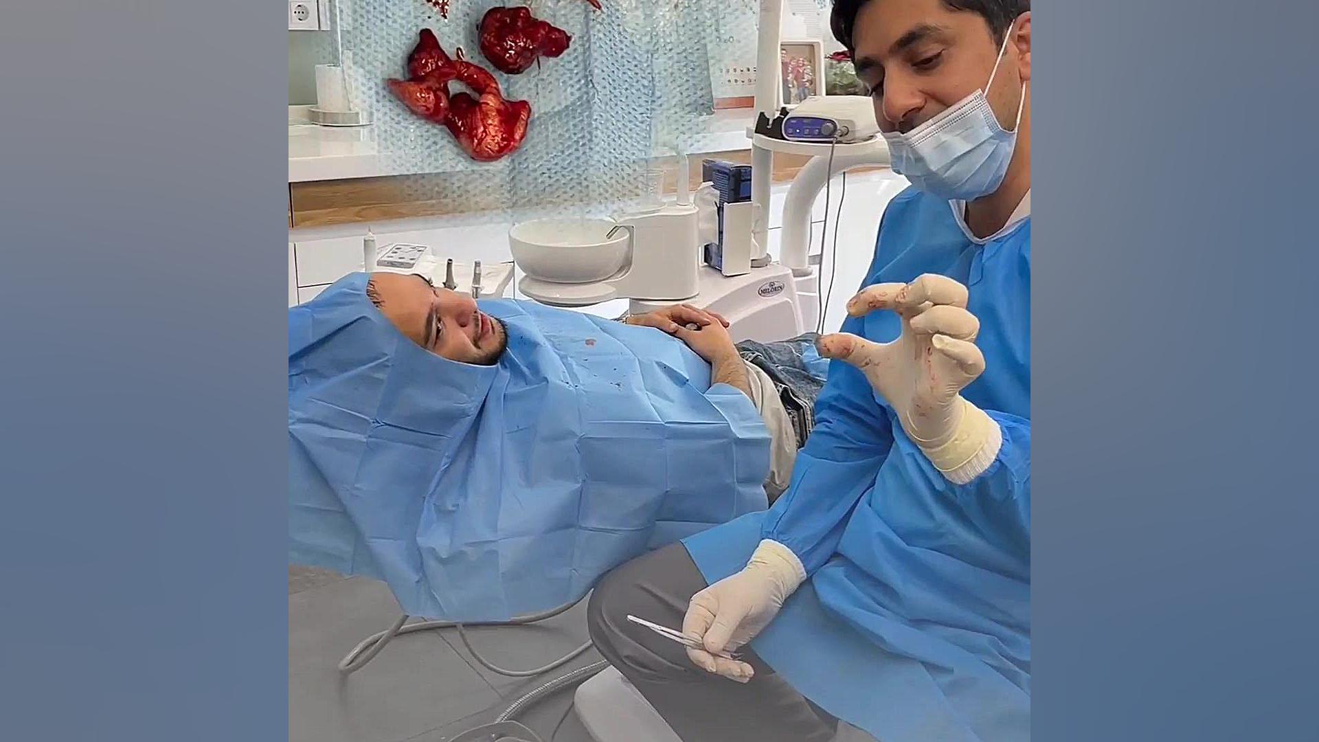 جراحی کیست فکی دکتر نیما دهقانی
