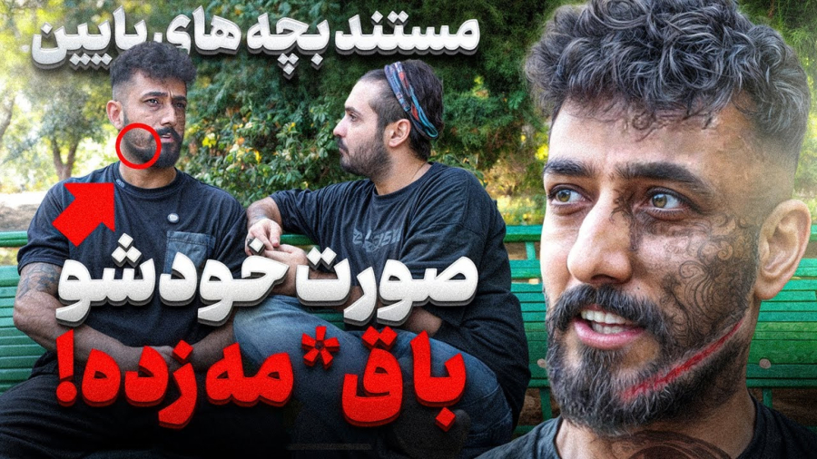 "امید جانی" کسی که بخاطر ازدواج مجدد باباش خونشو آتیش زد (مستند بچه های پایین)