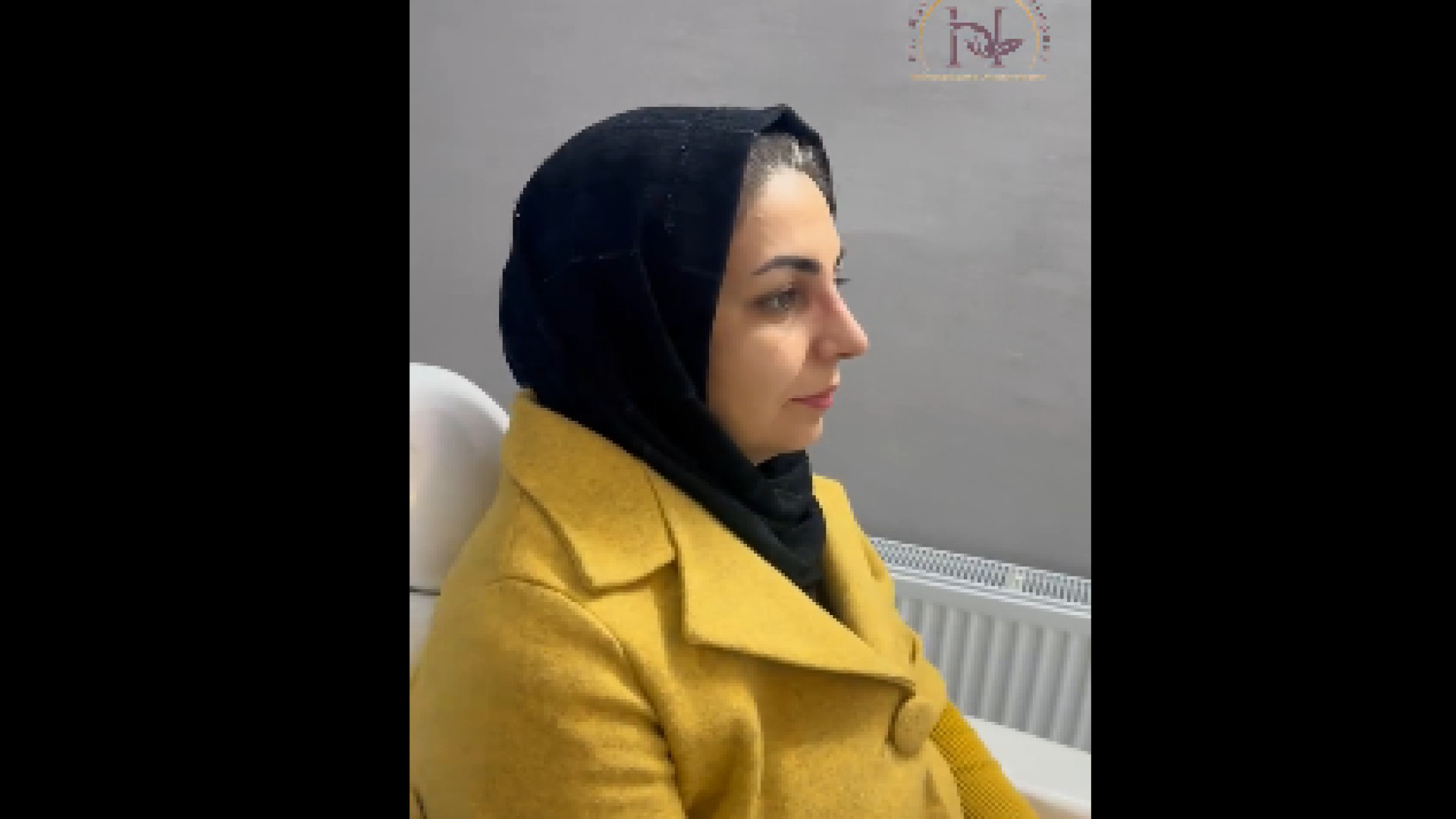 نتیجه عمل بینی دکتر معصومه حسین پور