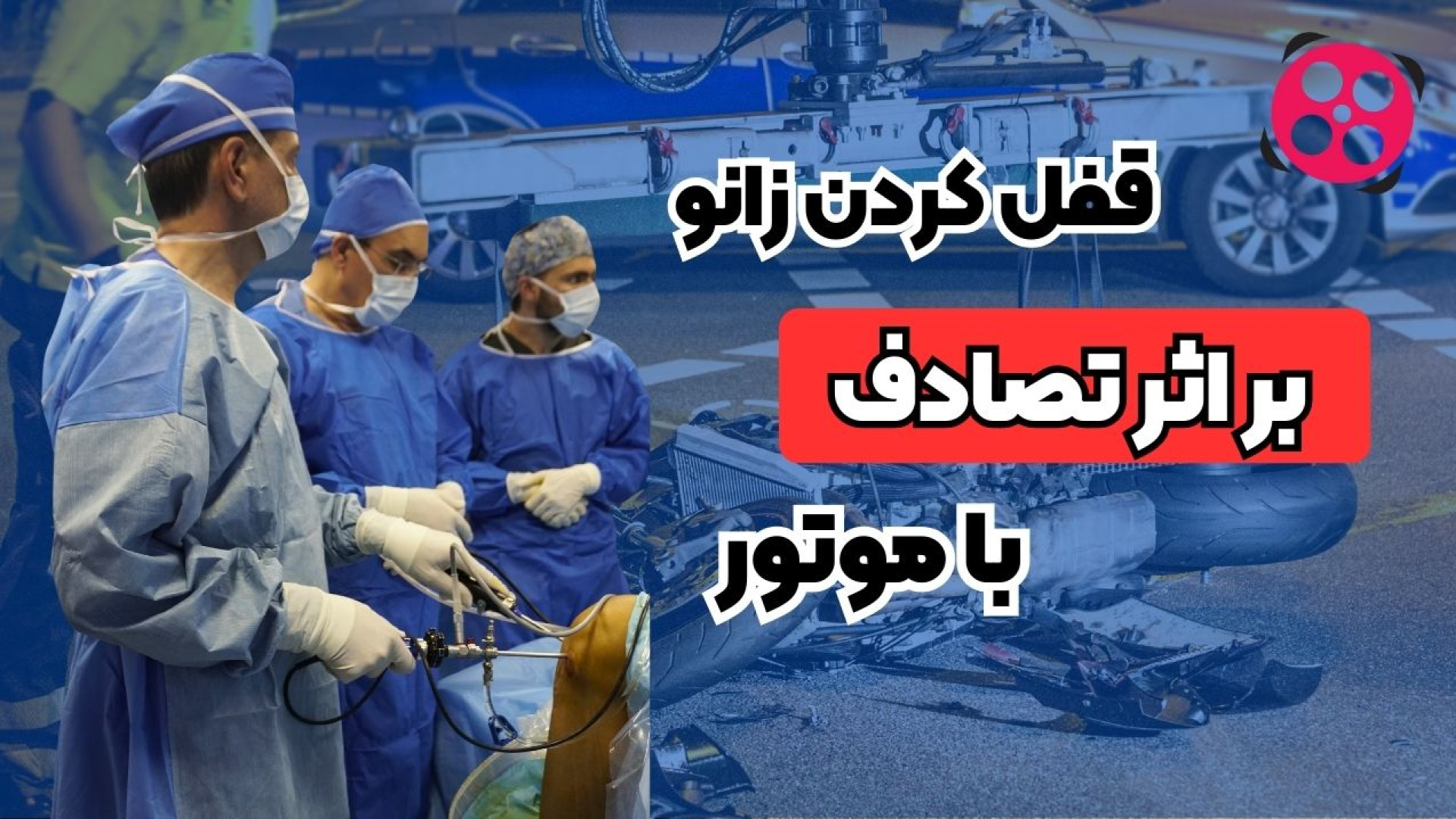 قفل کردن زانو بر اثر تصادف با موتور دکتر محمود جعفر بیگلو
