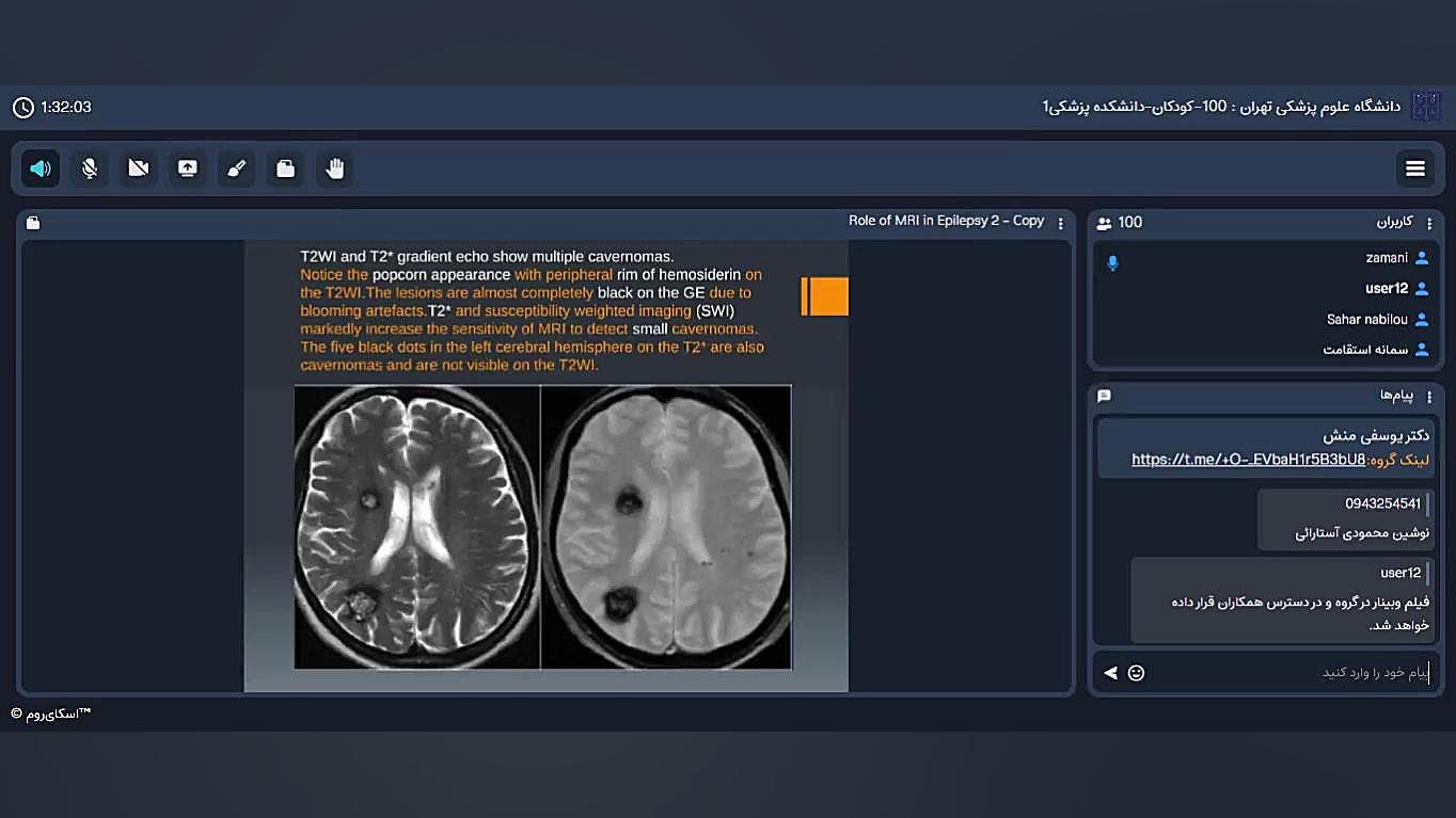 وبینار کاربرد MRI در صرع کودکان پاکسازی پوست