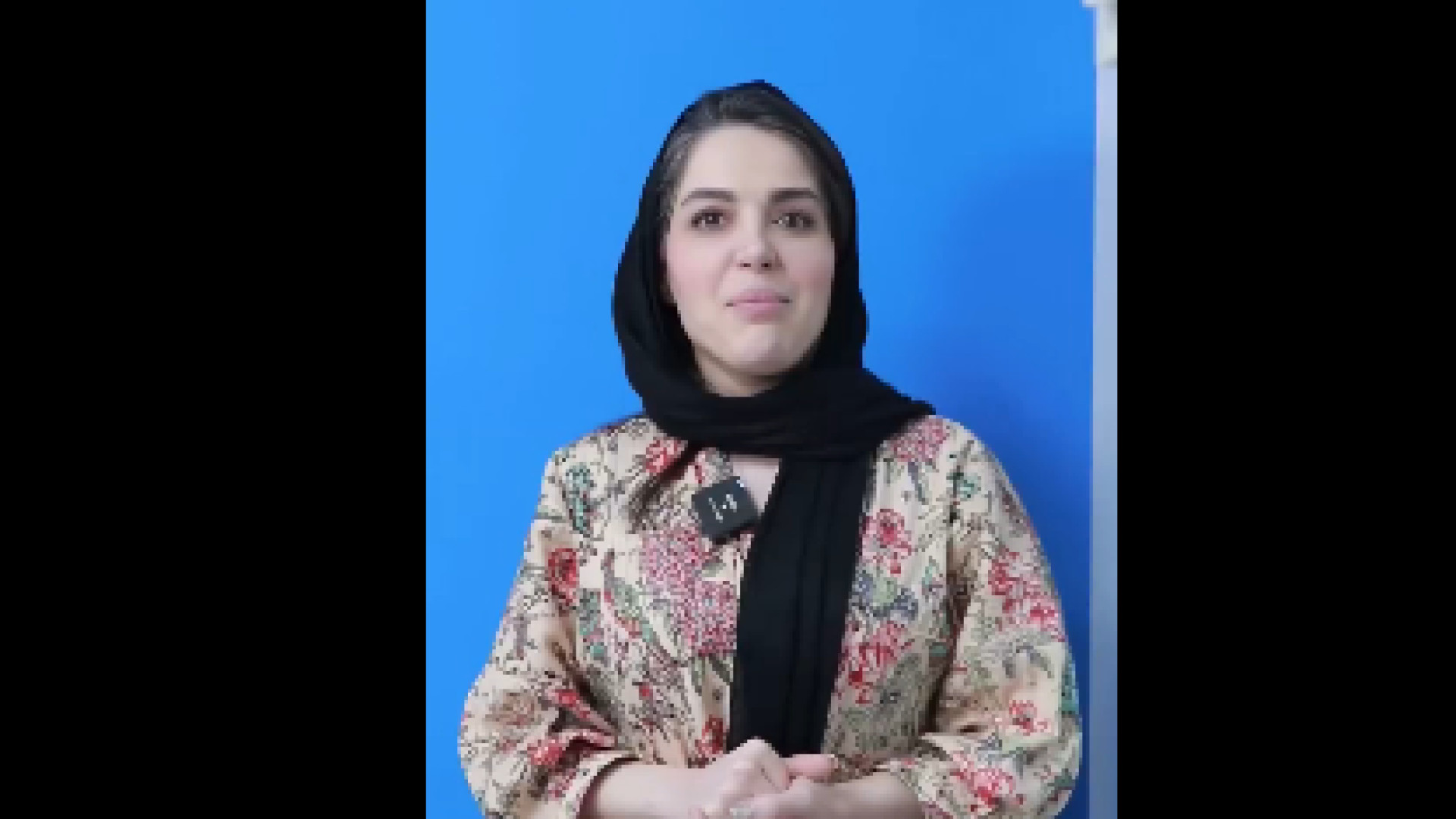 رضایت از لیپو ابدومینوپلاستی و پروتز سینه دکتر حسین پناه