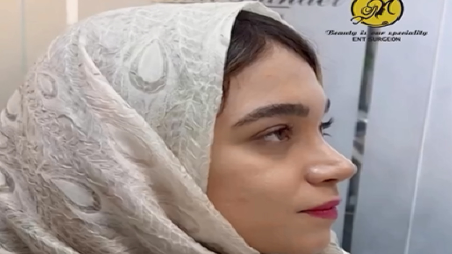 نمونه جراحی بینی گوشتی | دکتر مهدی بنائی