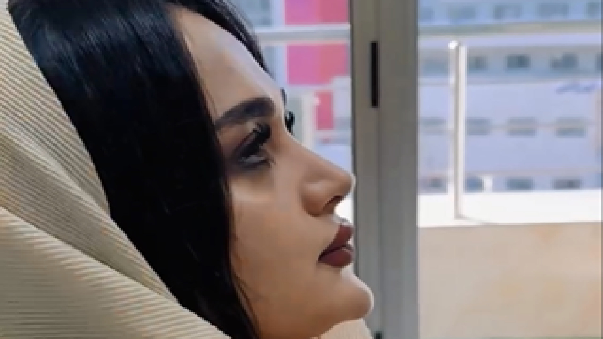 نمونه عمل بینی موفق | دکتر مهدی بنائی