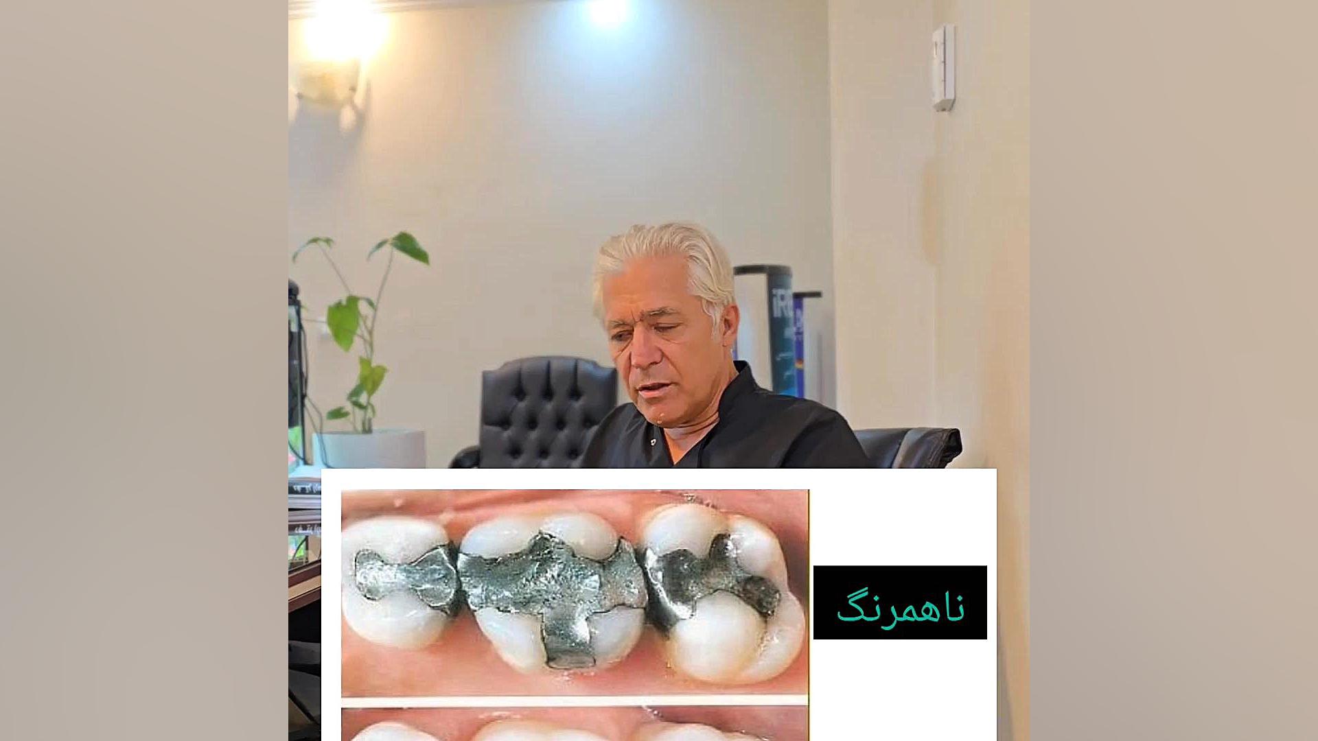 چه زمانی باید عصب کشی کنیم؟ عصب کشی خطرناک است؟ دندان بعد از عصب کشی ضعیف میشود؟ فیلم کوتاه