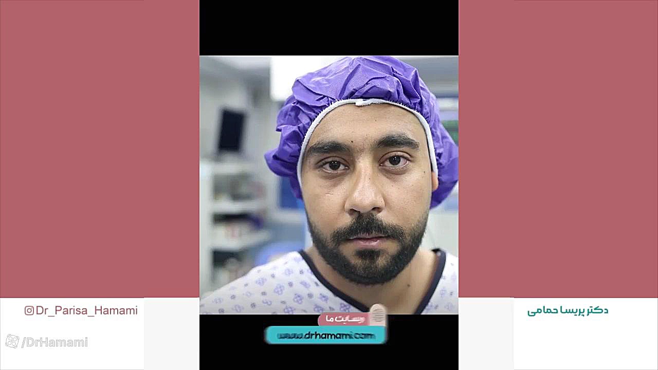 جراحی حدقه چشم به علت ضربه به چشم GRO-Seq