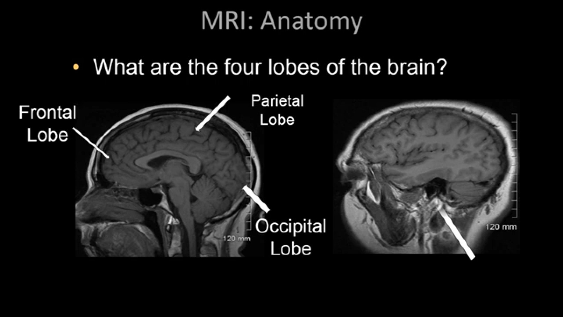 آناتومی MRI طبیعی مغز مهران مدیری