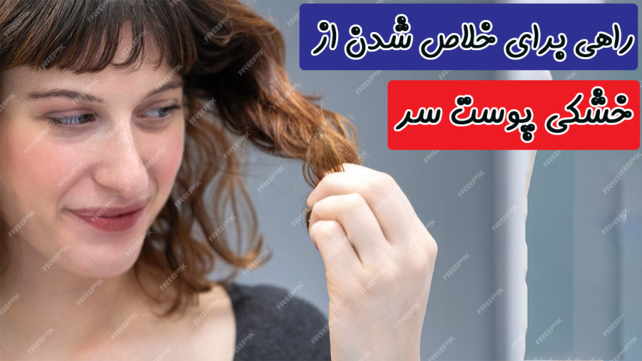 درمان خشکی پوست سر با روش‌های آسان