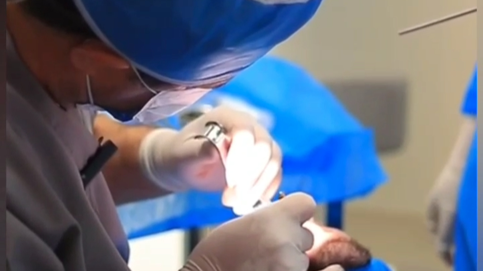 ایمپلنت بدون درد؟؟! مگه داریم؟! دندانپزشکی دکتر امیر صلح جو