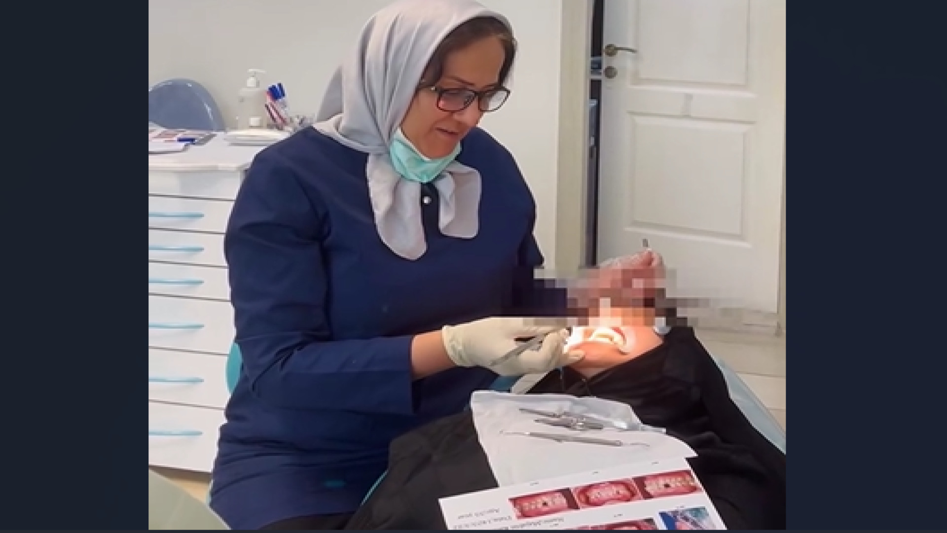 شروع درمان ارتودنسی در خانم ۵۵ ساله | دکتر ثریا یوسف نژاد دکتر ثریا یوسف نژاد متخصص ارتودنسی بابل