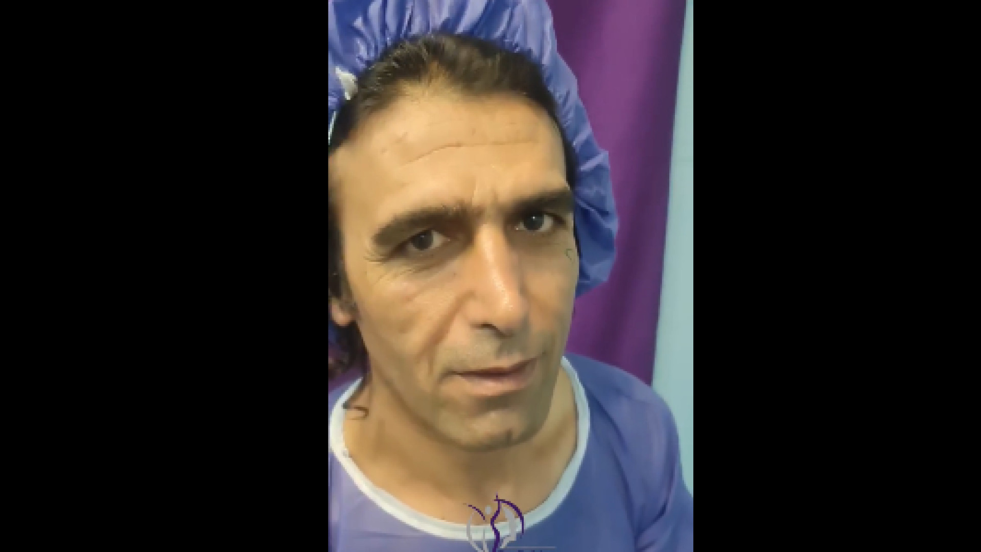 عمل لیفت صورت برای اقایان دکتر شاهین بهجو - فوق تخصص جراحی پلاستیک
