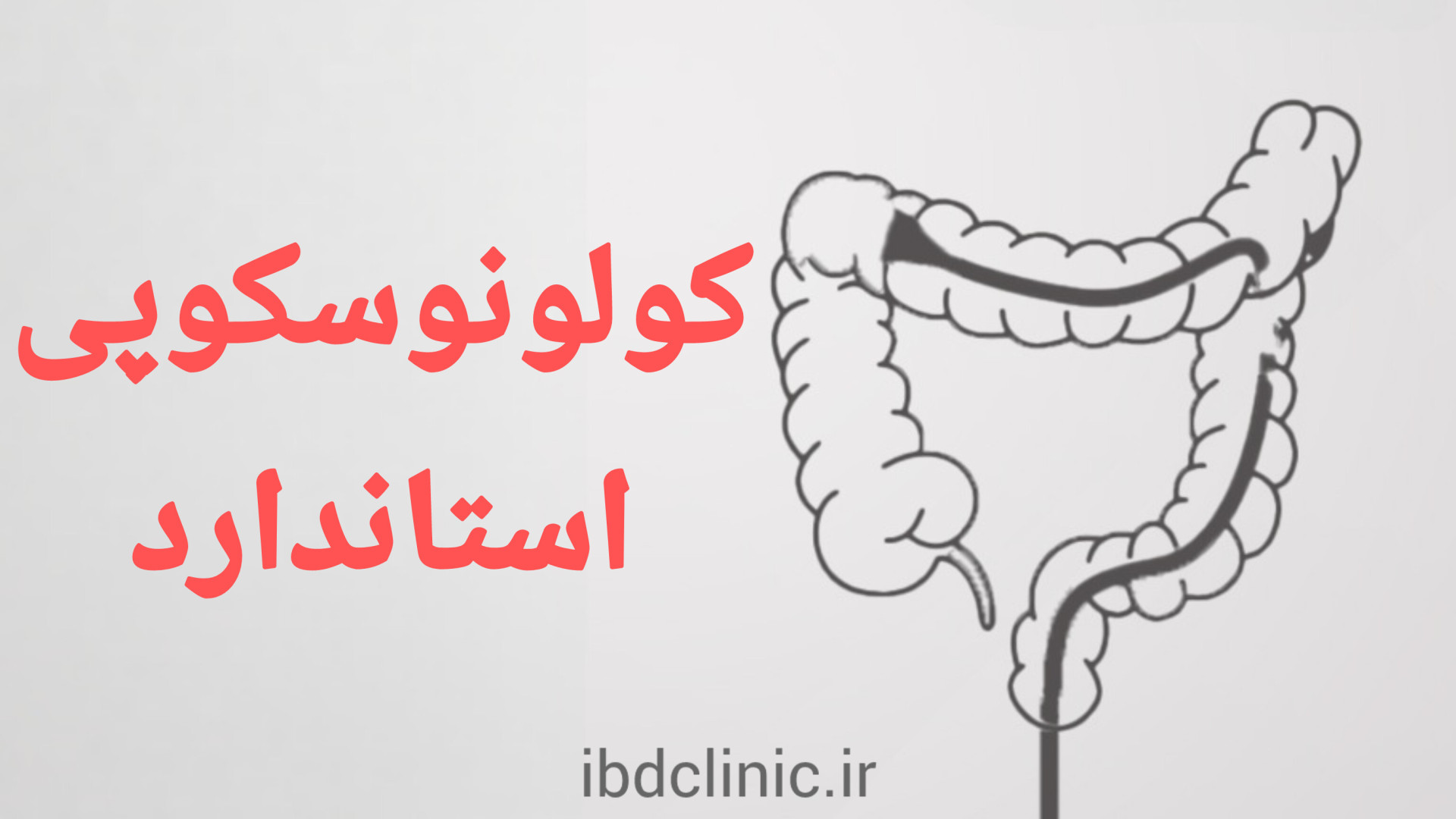 اپیزود یازدهم، خصوصیات کولونوسکوپی دقیق در کرون و کولیت اولسروز دكتر عليرضا سيما
