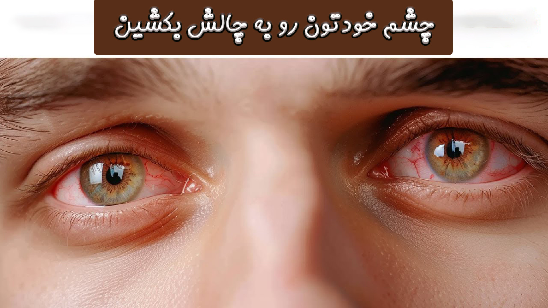 آیا چشمانتان تیزبین هستند؟ تست سریع و جالب! رفع افتادگی پلک