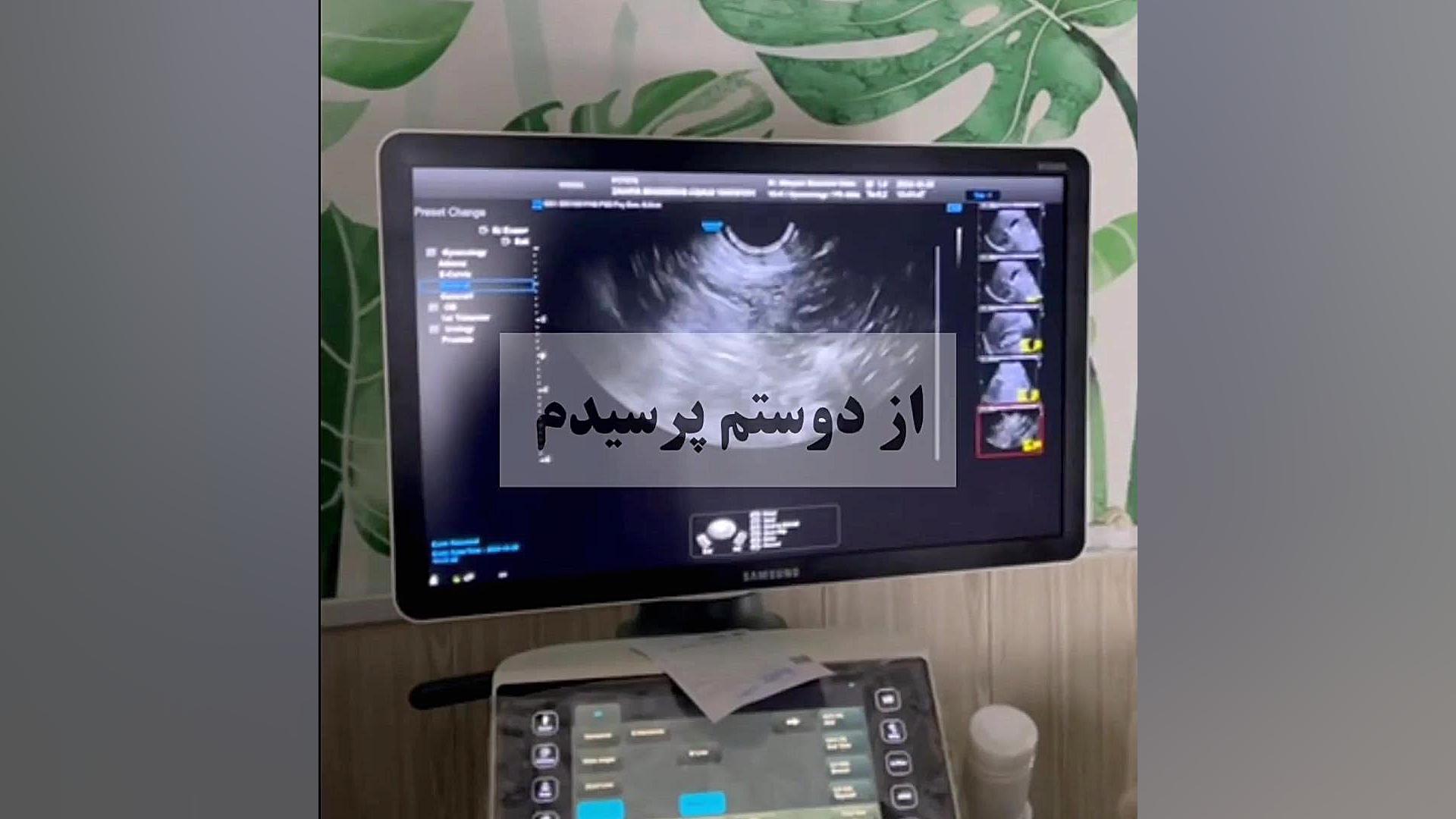 ترس از سونوگرافی مرکز تصویربرداری دکتر مریم ابراهیمی، مبنا-تهران