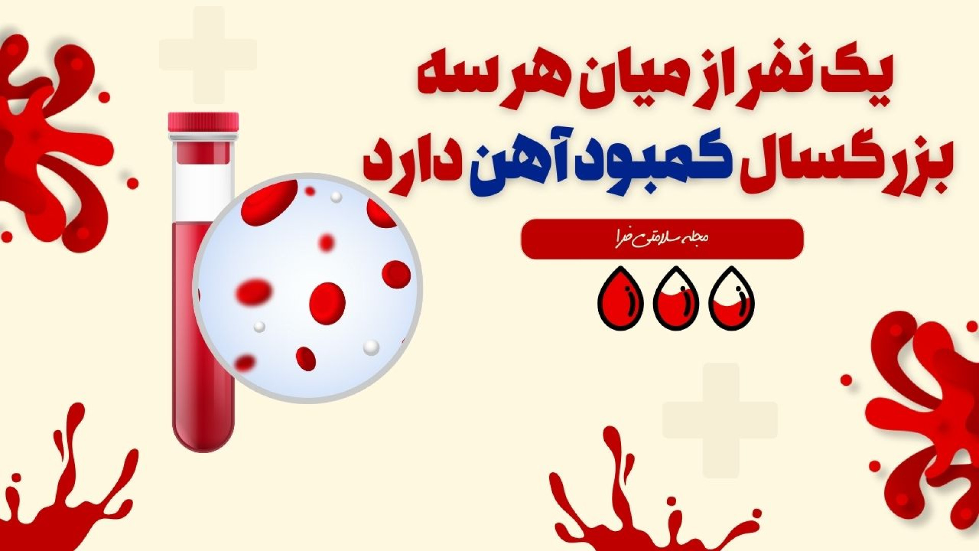 یک نفر از میان هر سه بزرگسال کمبود آهن دارد لیزر فرکشنال