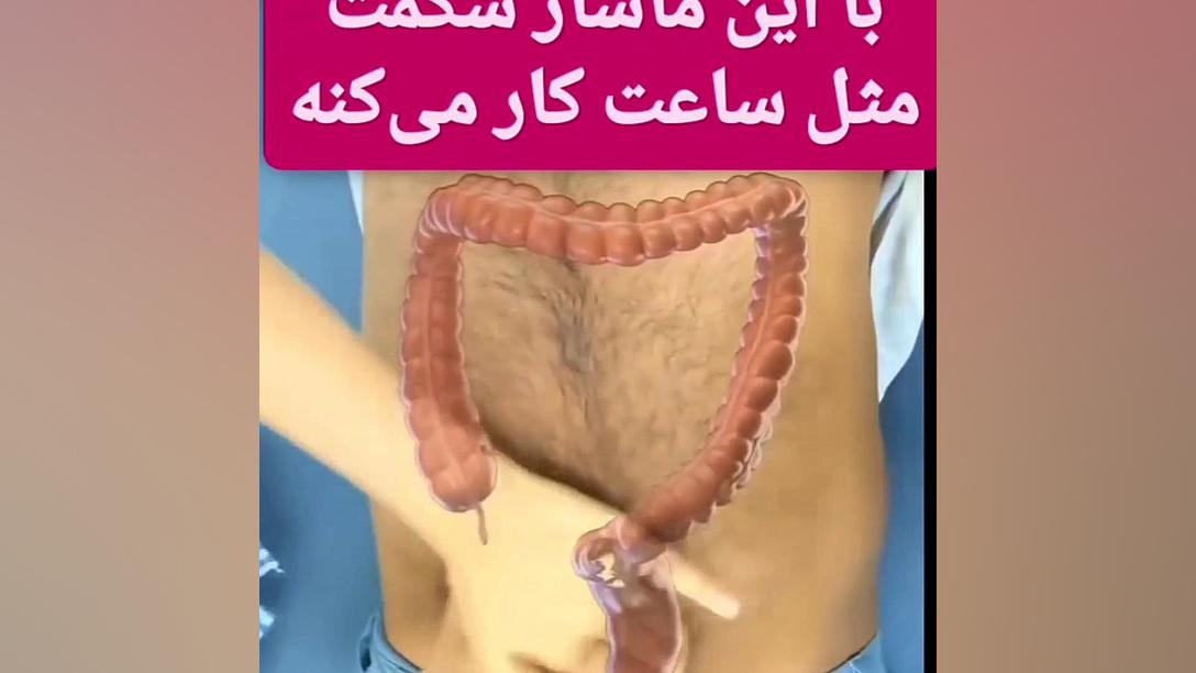 یبوست داری ببین09909982599|سعیدی کامپوزیت ونیر