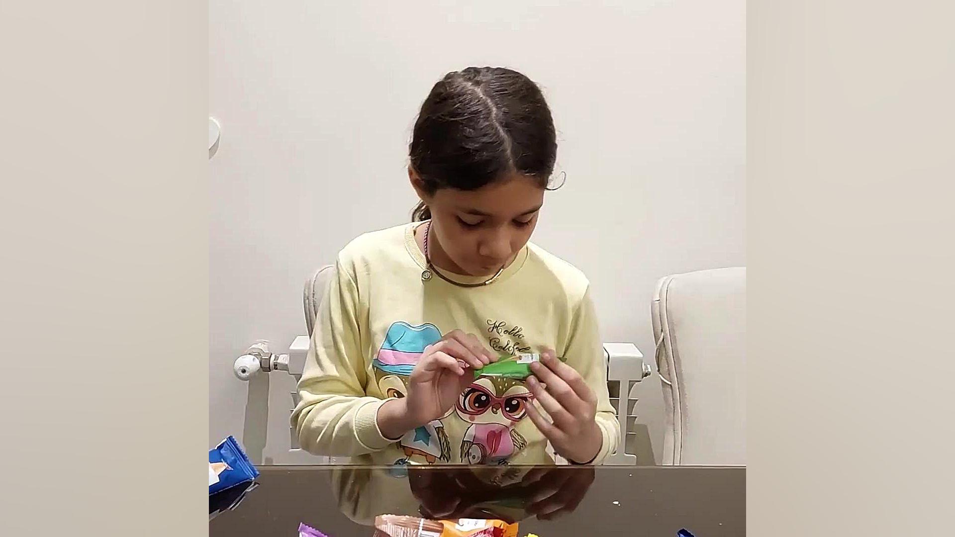 تست شکلات سوربن کاشت مو