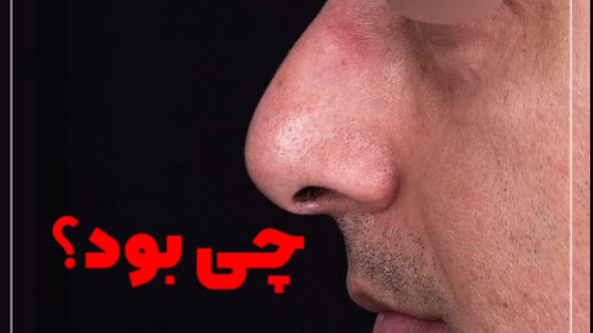 تغییر شگفت انگیز با جراحی زیبایی بینی | دکتر باقری حق دکتر علی باقری حق