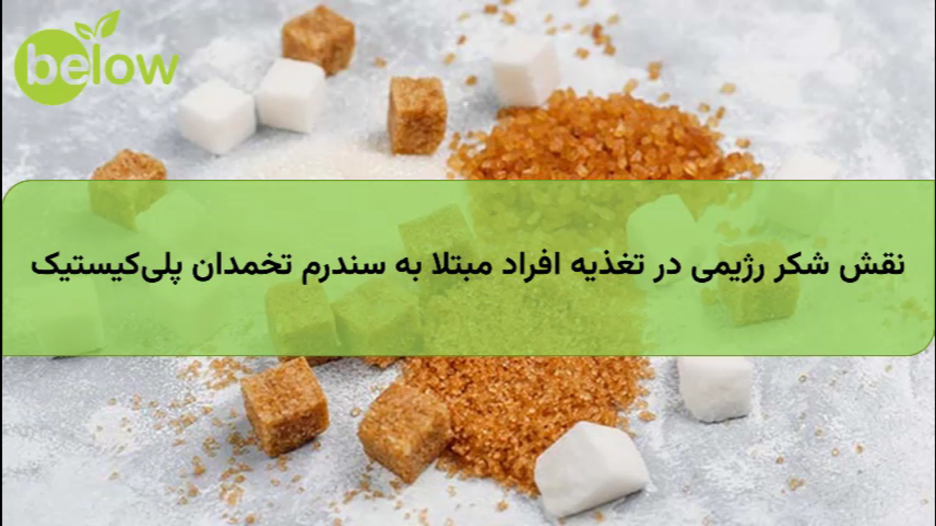 نقش شکر رژیمی در تغذیه افراد مبتلا به سندرم تخمدان پلی‌کیستیک پلاسماجت