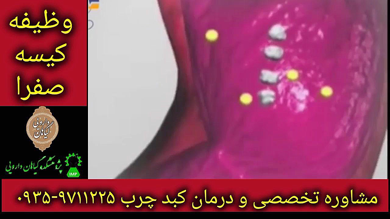 وظیفه کیسه صفرا. درمان قطعی کبد چرب ۰۹۳۵۹۷۱۱۲۲۵ Northern Blot