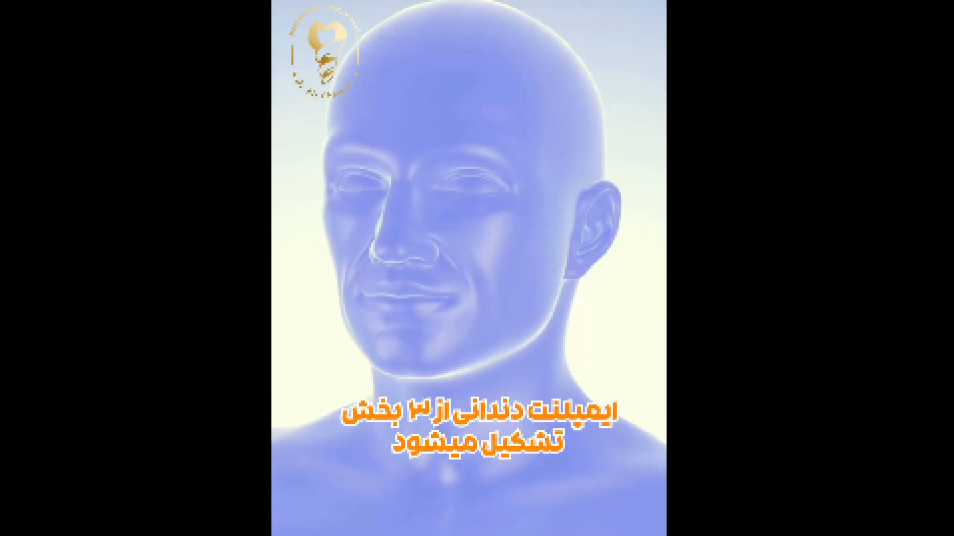 ایمپلنت دندانی دکتر علی قمری - متخصص جراحی لثه و ایمپلنت