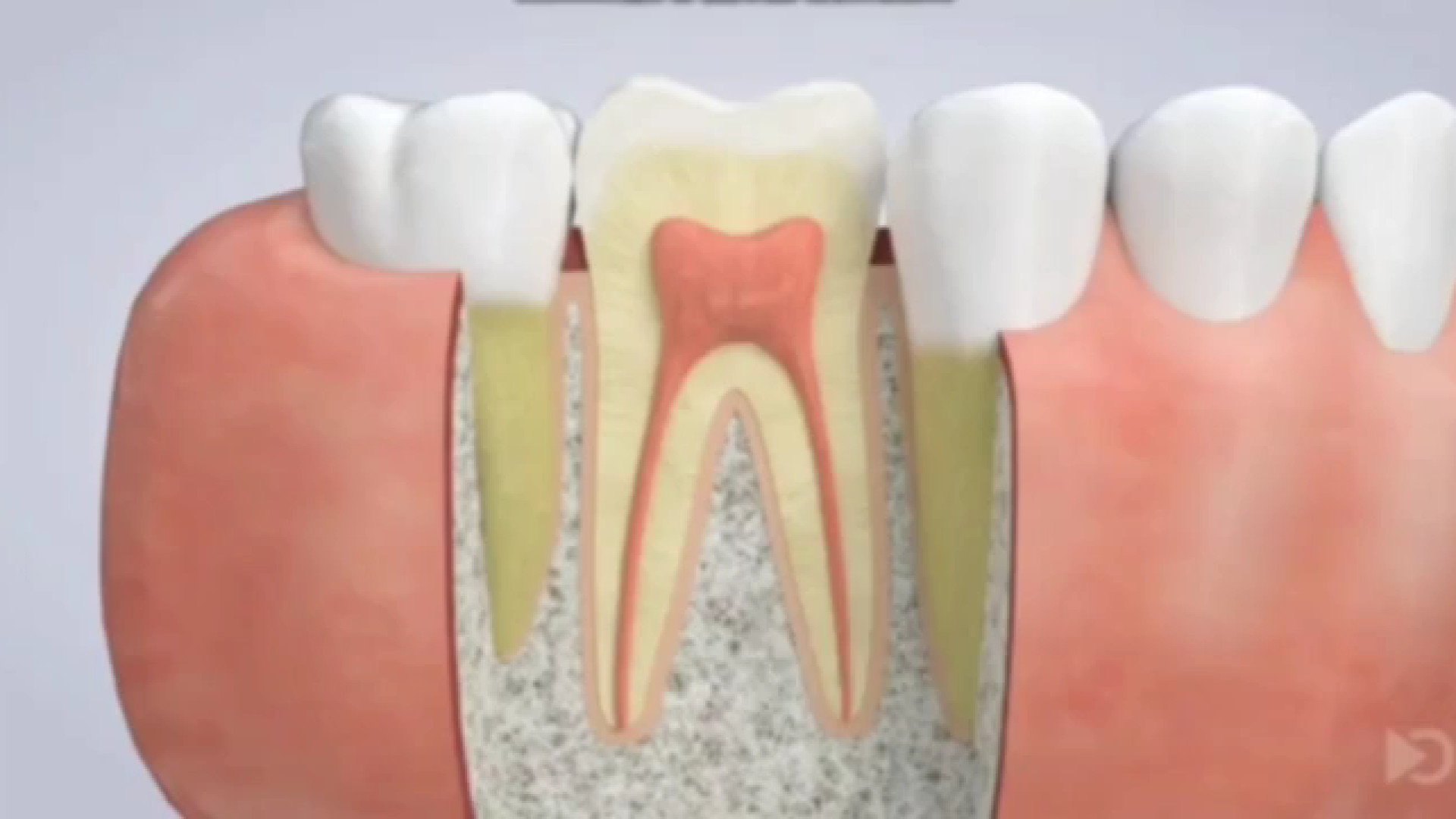 درمان ریشه دندان | Root Canal Treatment | Endodontics دکتر سمانه شهابی || جراح، دندانپزشک و متخصص اندو
