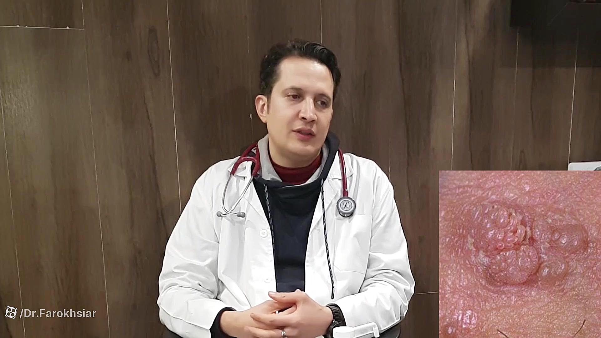 درمان hpv وزگیل تناسلی و خال دکتر مهدی فرخ سیر؛متخصص عفونی؛سعادت آباد آزمون فعالیت آنزیم G6PD