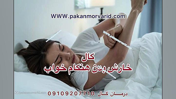 درمان گیاهی بیماری گال ایربسارتان
