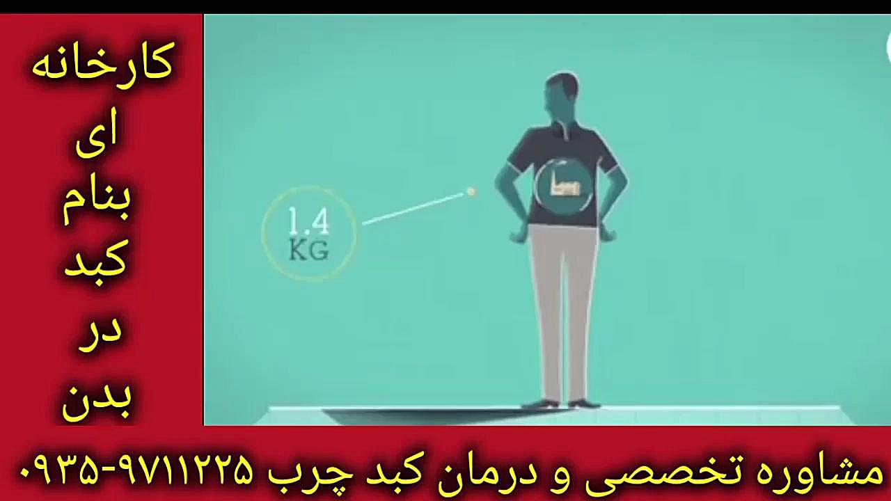تولیدات حیاتی کبد درمان قطعی کبد چرب ۰۹۳۵۹۷۱۱۲۲۵ ماستوسیتوز