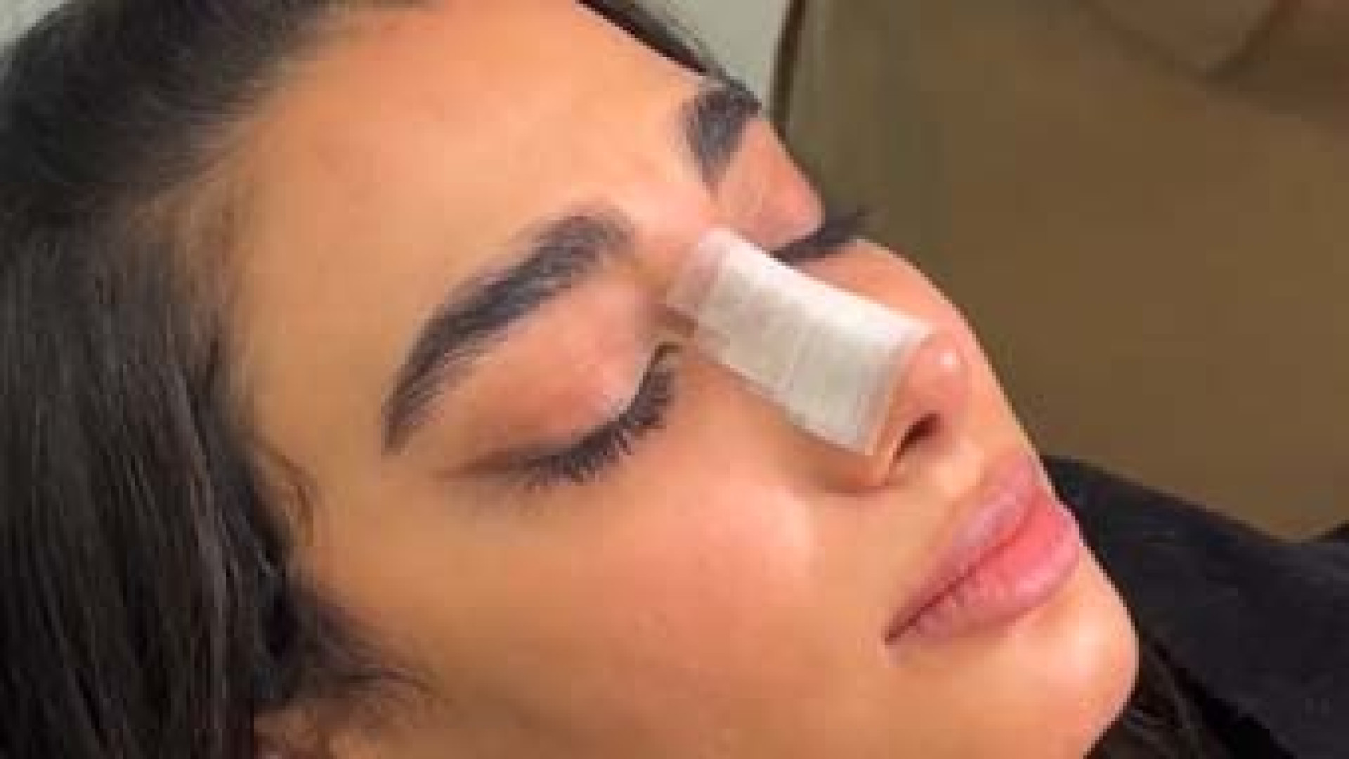 آموزش چسب زدن بینی | دکتر محمد مجیدی دکتر محمد مجیدی - جراحی بینی به سبک طبیعی شیک