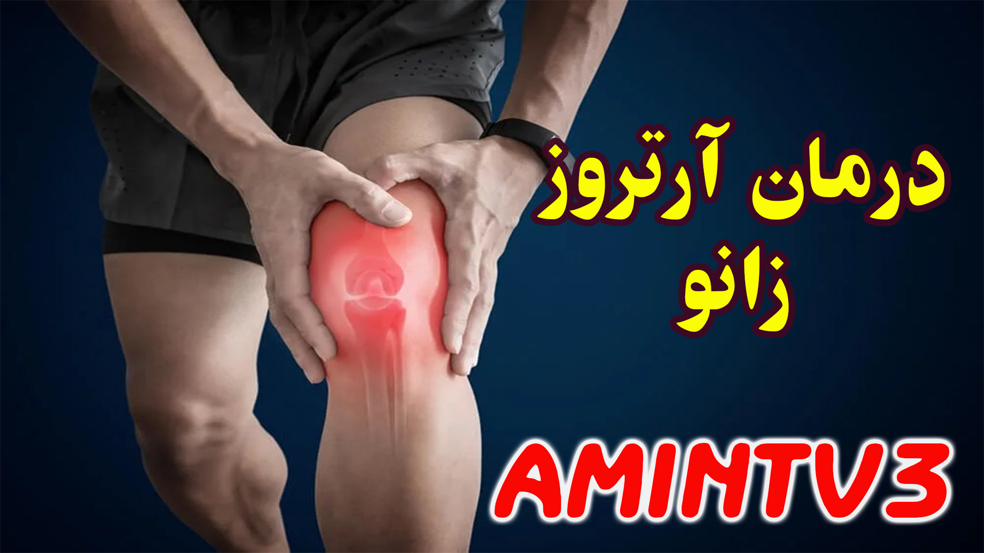 راه های درمان آرتروز زانو و تقویت زانو جراحی بینی