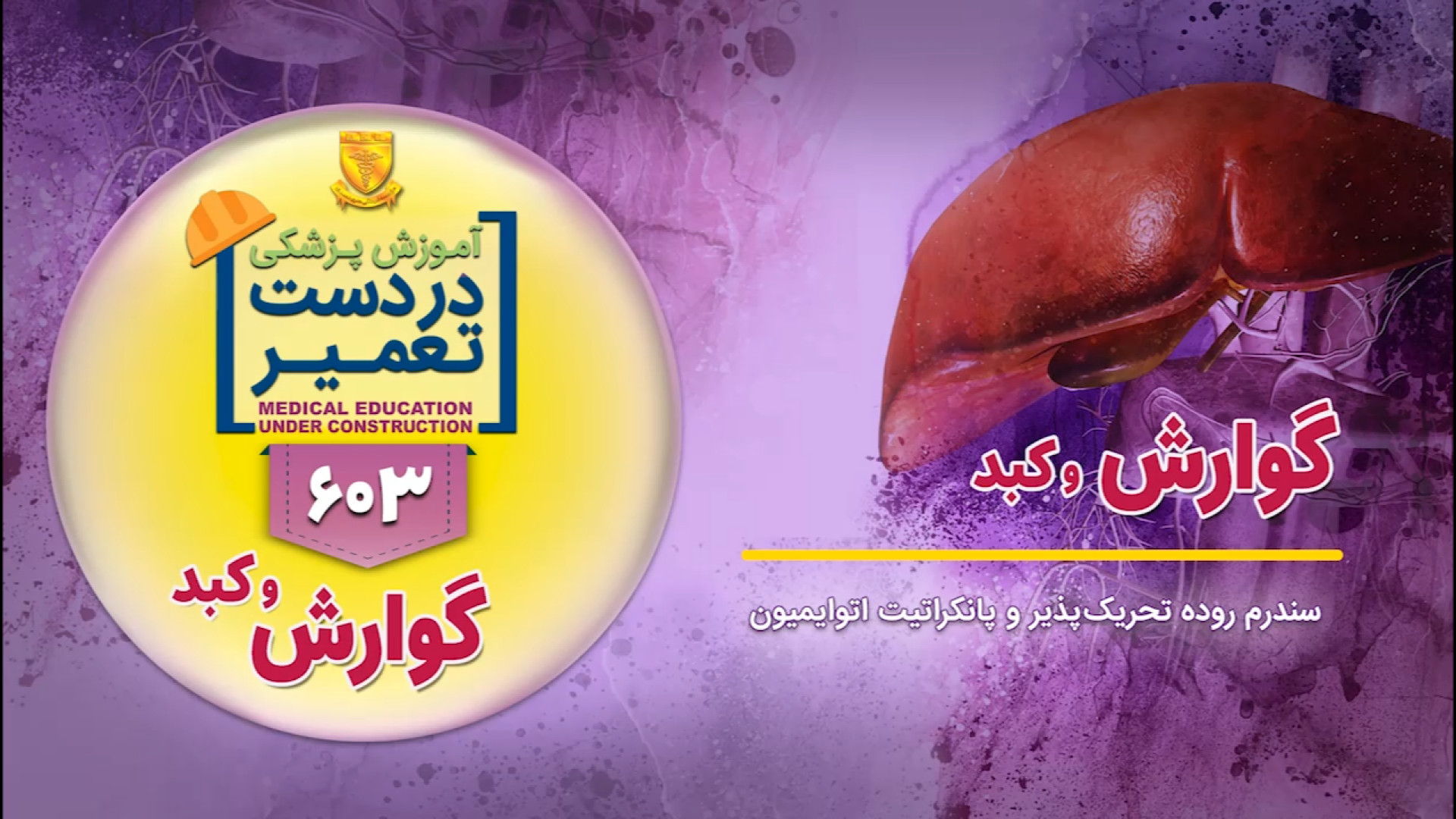 گوارش و کبد (سندرم روده تحریک پذیر) محسن چاوشی