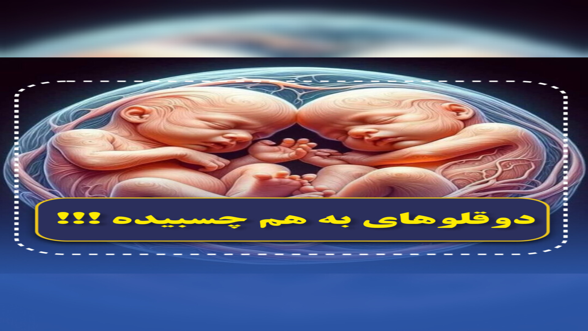 دوقلوهای بهم چسبیده!!!! یه تراژدی ترسناک!!! مرکز تصویربرداری دکتر مریم ابراهیمی، مبنا-تهران