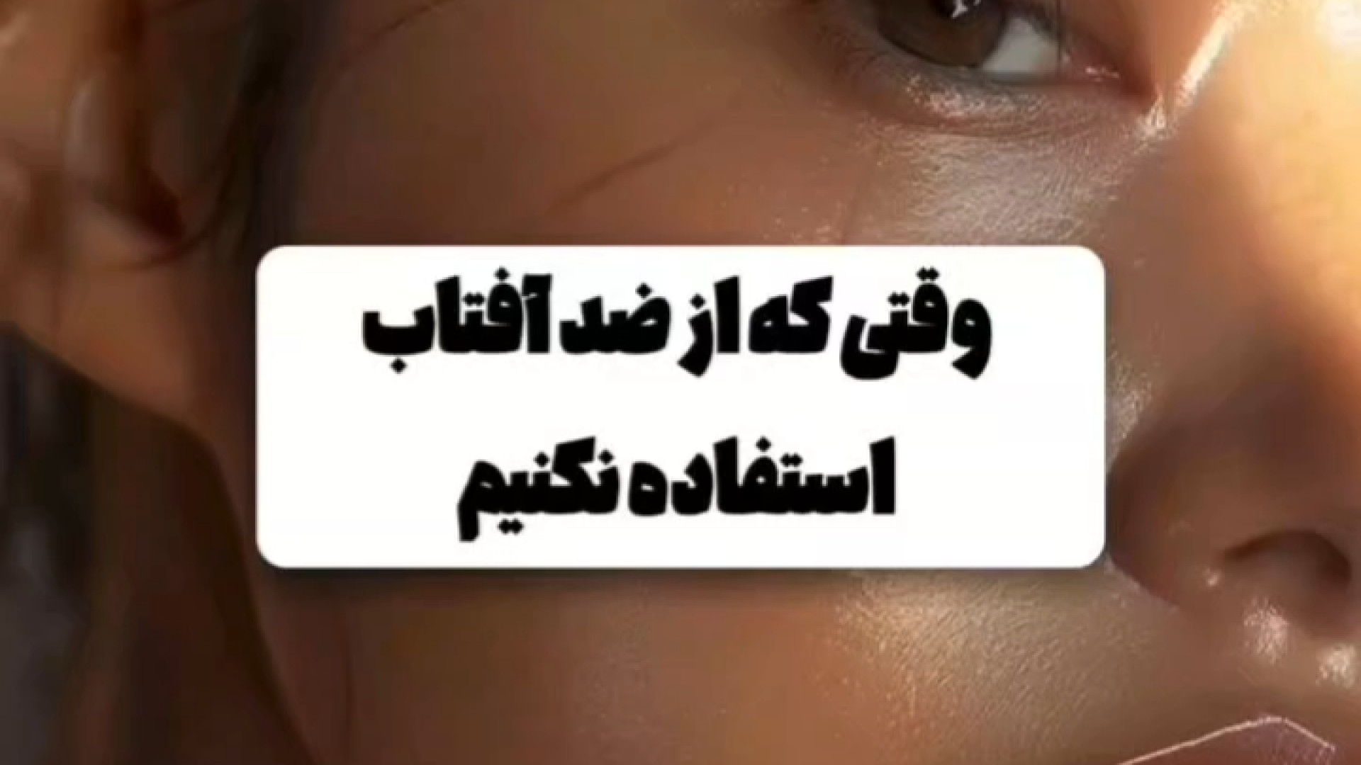 عوارض استفاده نکردن از ضدآفتاب دکتر امیر سلیمانی