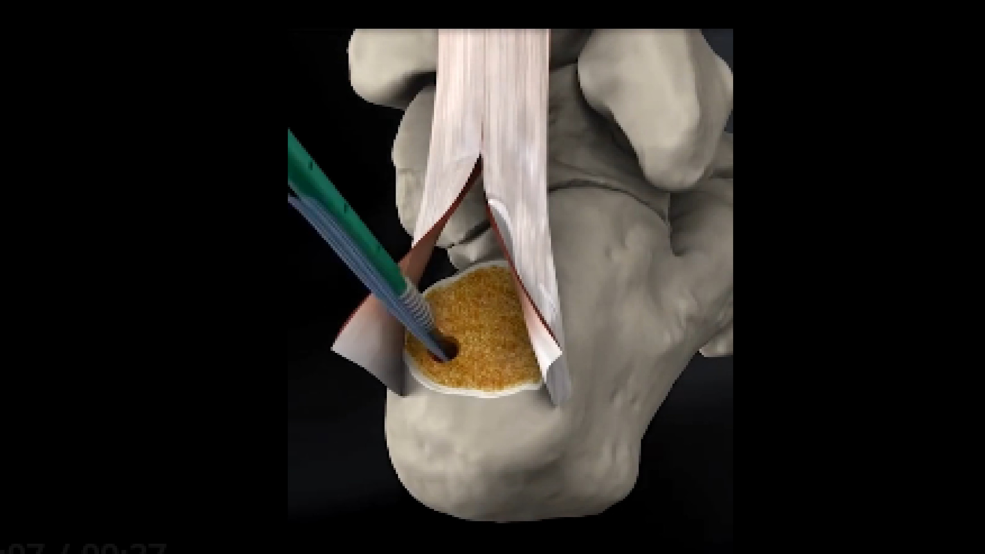 ناهنجاری هاگلند دکتر آرش اریس