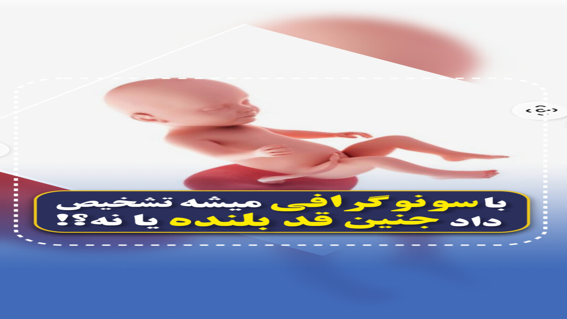 چجوری بفهمیم جنینمون قدبلنده یا نه! مرکز تصویربرداری دکتر مریم ابراهیمی، مبنا-تهران