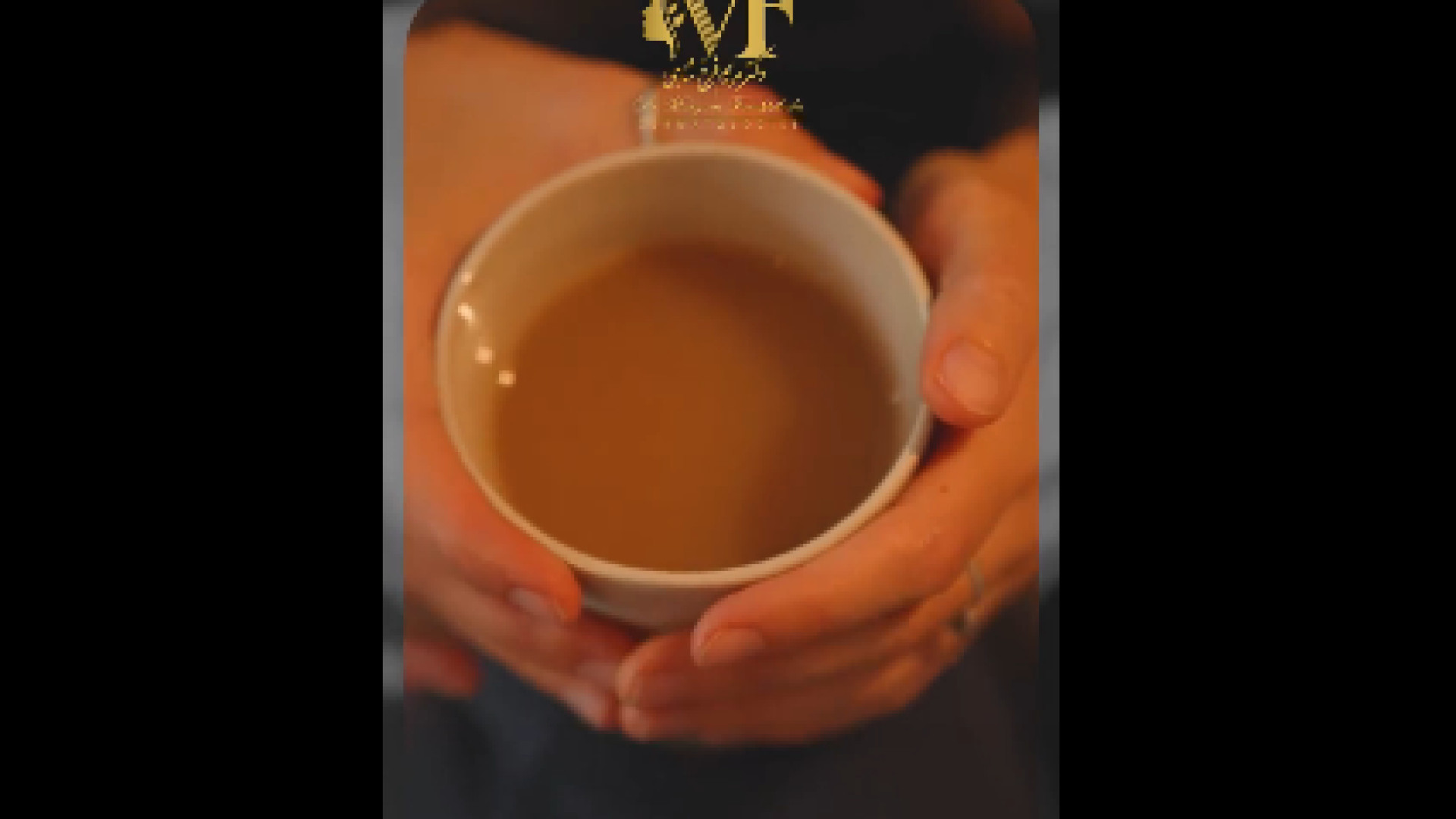 مراقبت بعد از فیلر لب دکتر مریم فرخشاهی - پوست، مو و زیبایی