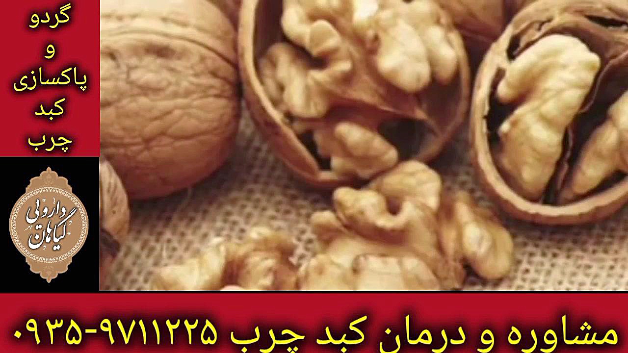 مصرف گردو درمان قطعی کبد چرب ۰۹۳۵۹۷۱۱۲۲۵ لیزر موهای زائد