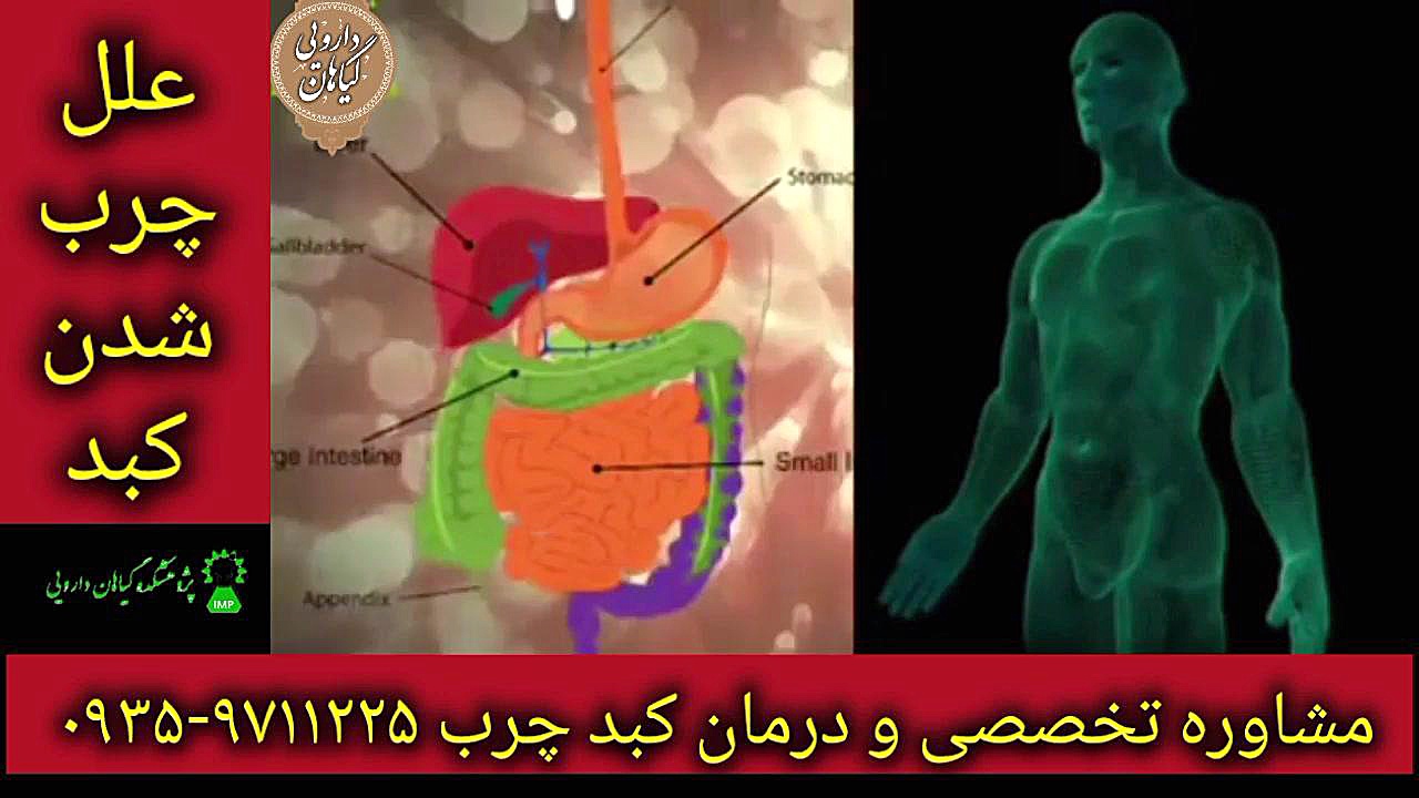 علل ابتلا به کبد چرب درمان قطعی کبد چرب ۰۹۳۵۹۷۱۱۲۲۵ Metagenomics