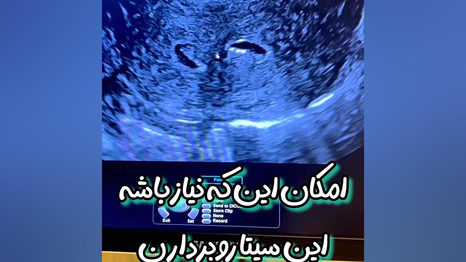 سونوگرافی سه بعدی از رحم تا حالا شنیده بودی؟ مرکز تصویربرداری دکتر مریم ابراهیمی، مبنا-تهران