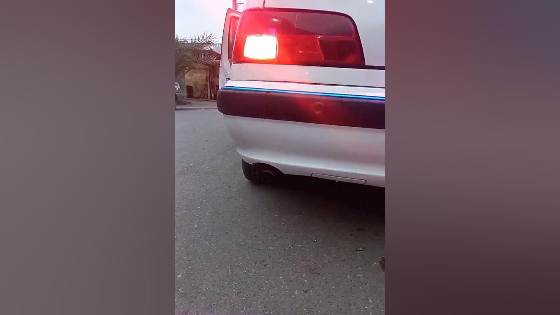 آنباکس و تجربه خرید منبع اگزوز مدل blchi سندرم تریشن-کولینز نادر