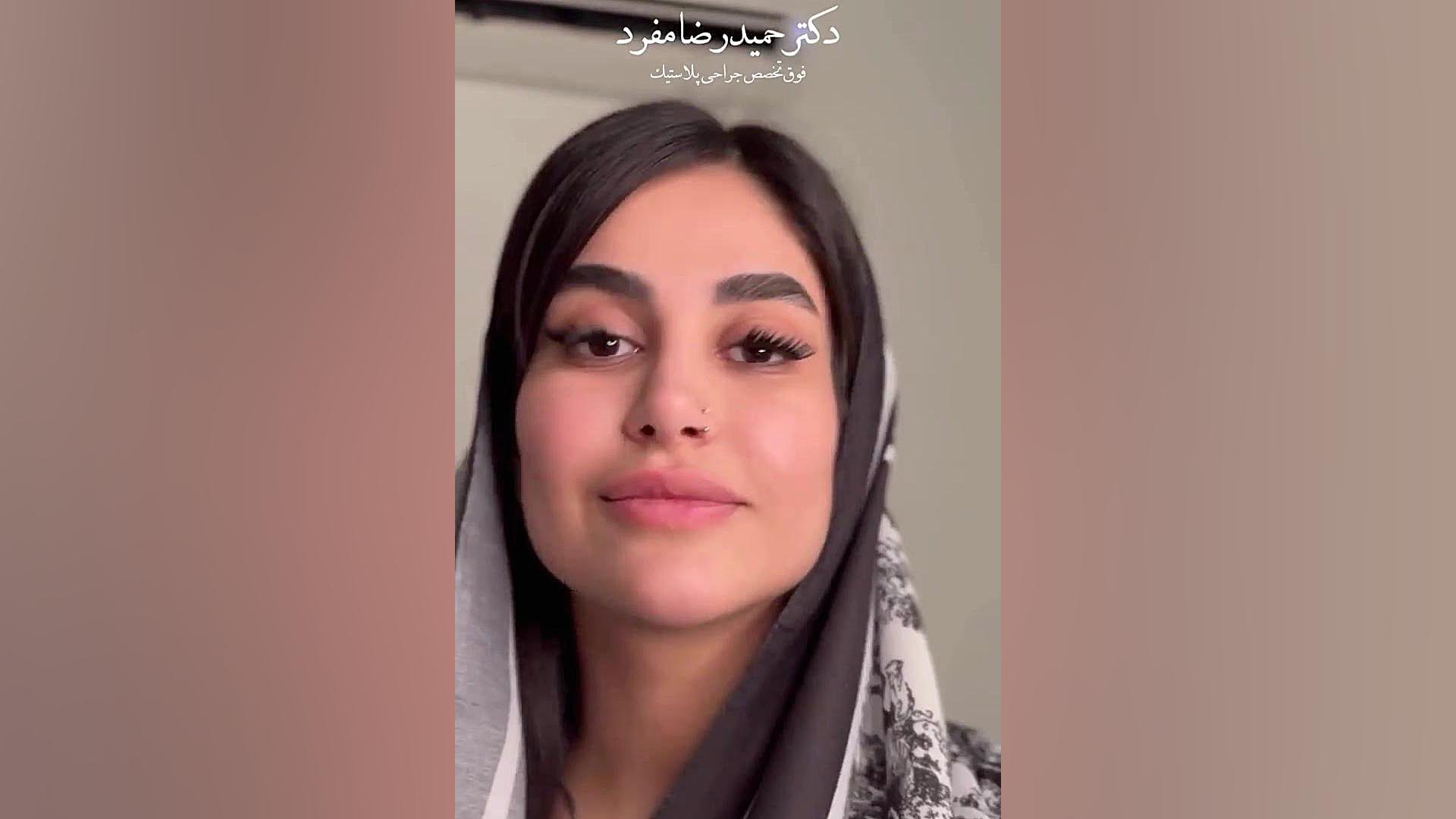 شش سال از جراحی بینی دختر خوبمون مهسا جان میگذره دکتر حمیدرضا مفرد