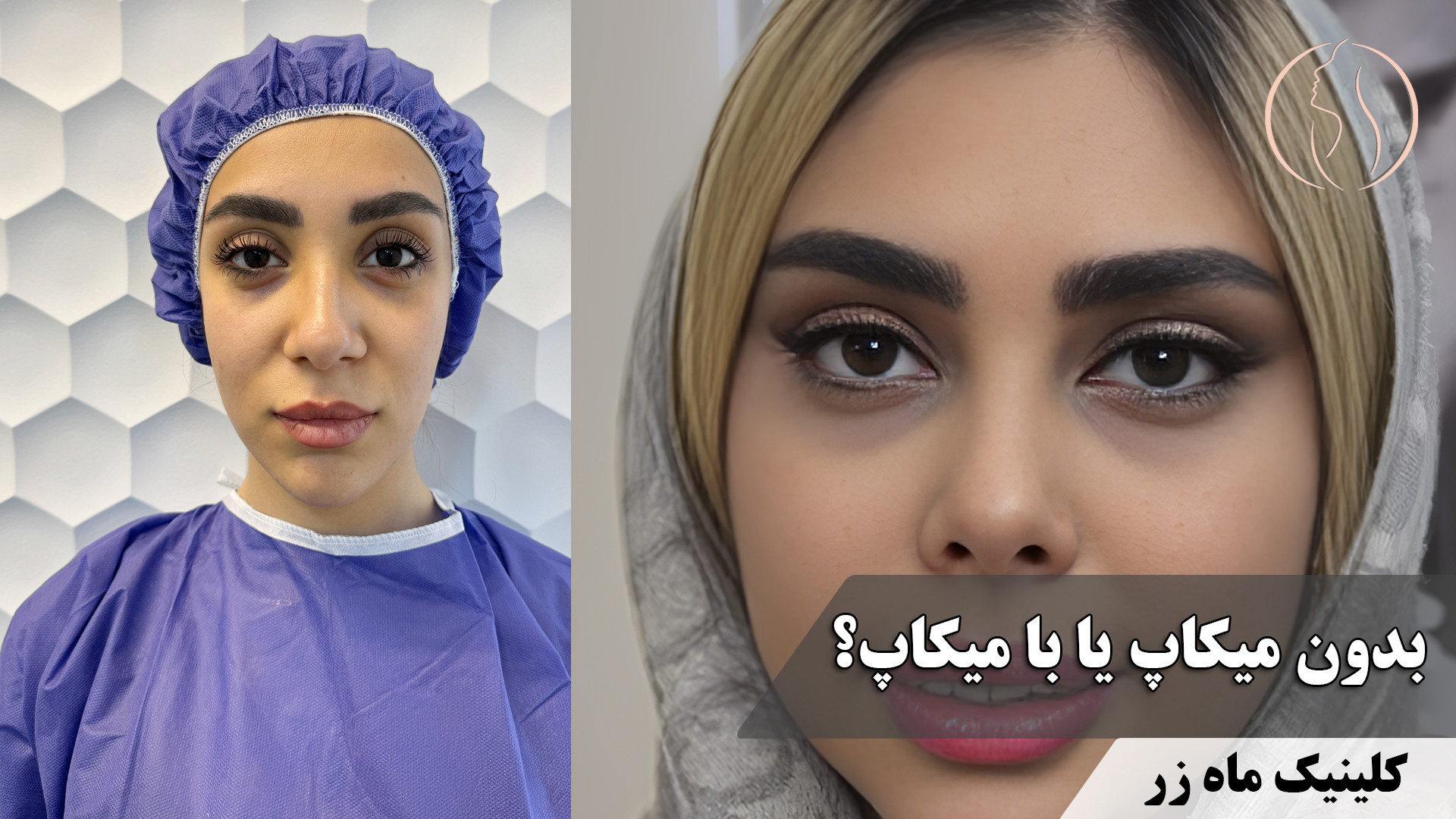 زیبایی، میراثی که خودت می‌سازی! ( کلینیک زیبایی ماه زر ) کلینیک مو