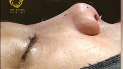 truncate dir-rtl
