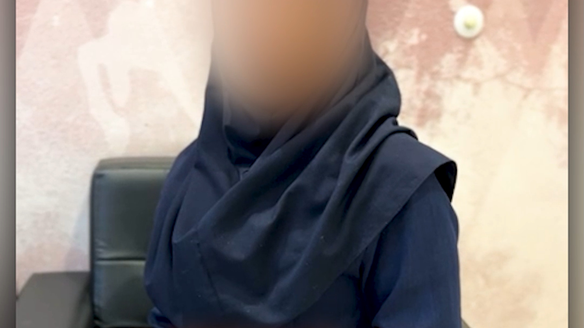 رضایت از پروتز سینه علامت لاسگ