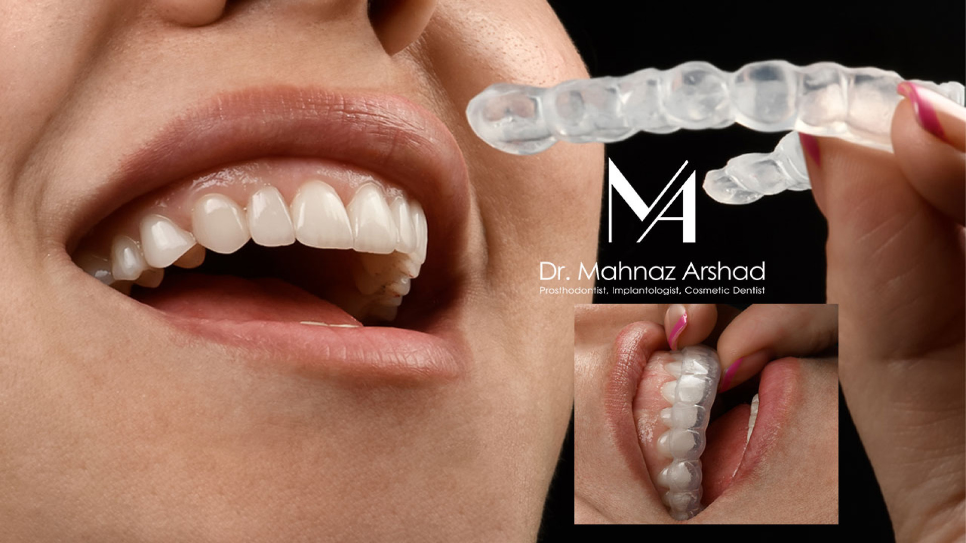 درمان تخصصی مشکلات مفصل فکی و گیجگاهی دکتر مهناز ارشد