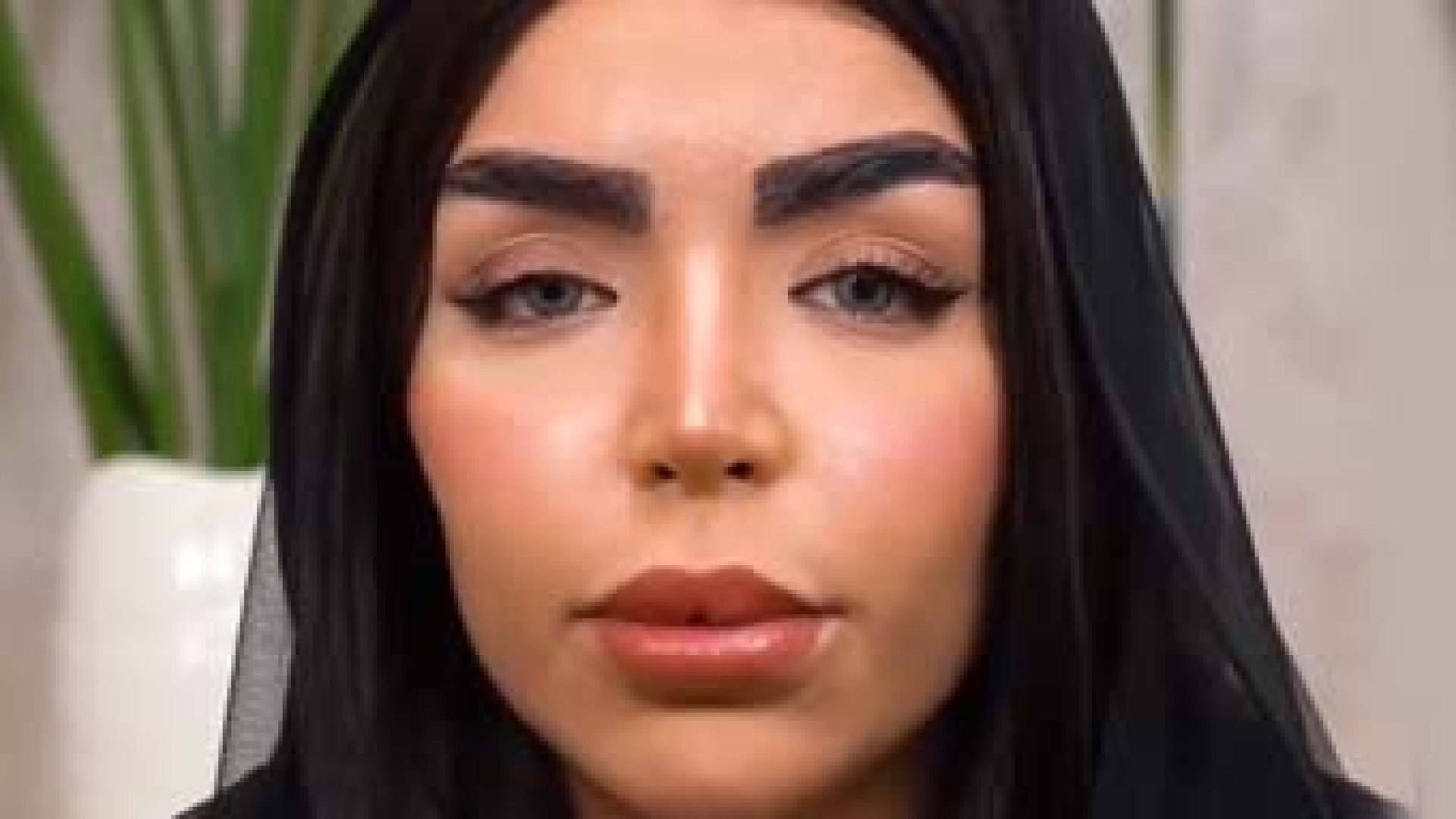 یک ماه بعد از پروتز سینه | دکتر محمد هادیزاده Cytotoxicity Assay