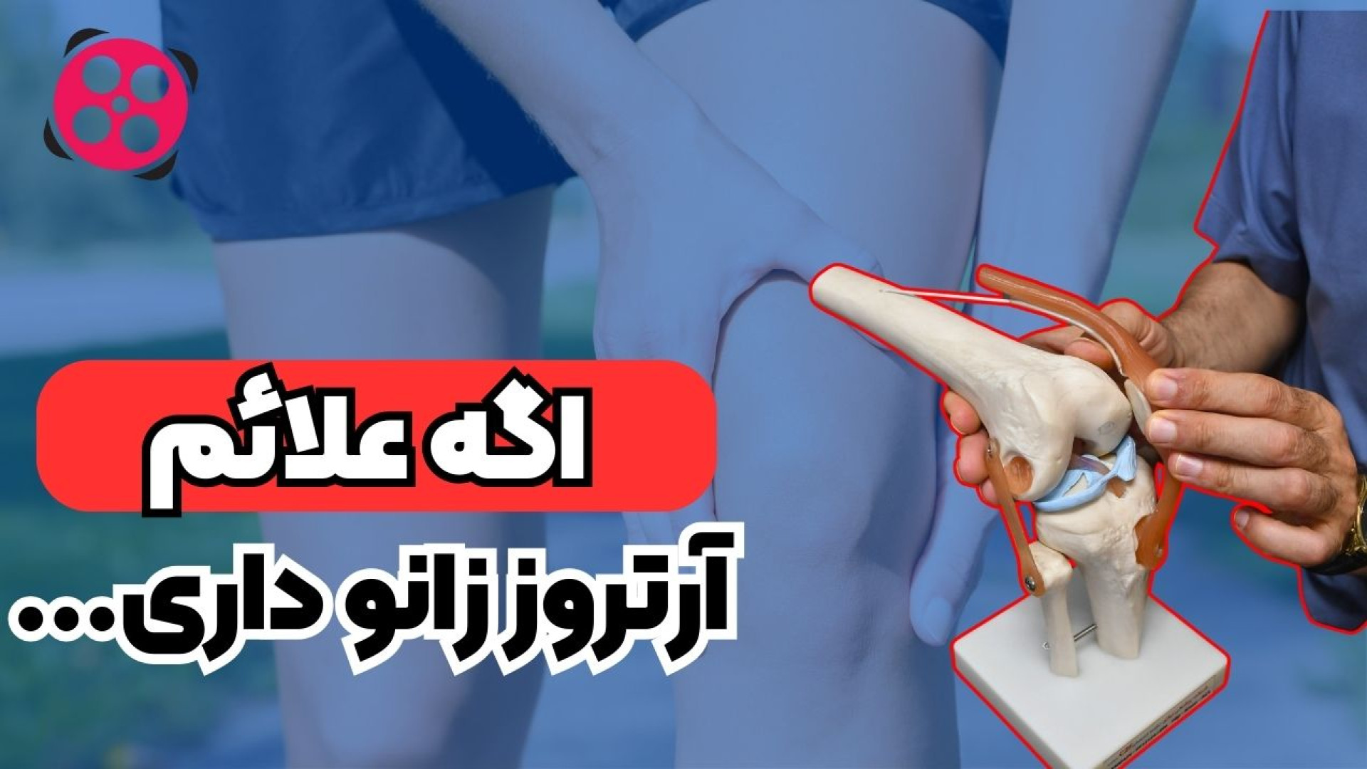 اگر علائم ارتروز زانو داری! دکتر محمود جعفر بیگلو